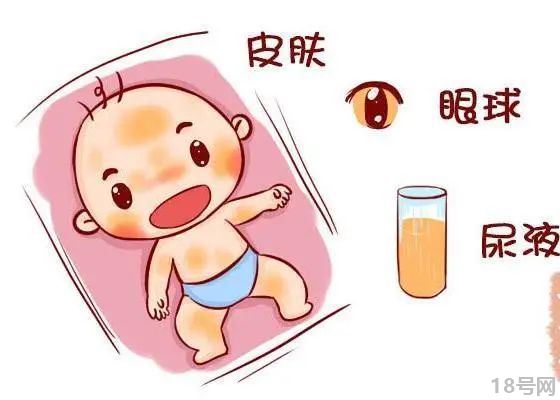新生儿黄疸高有什么危害？