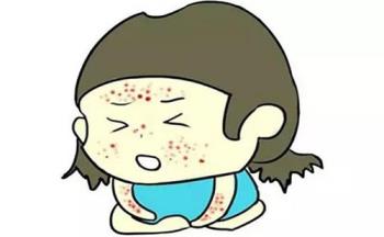 湿疹怎么治疗 湿疹的日常护理要点