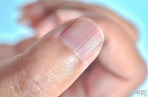指甲有竖纹是身体的什么信号1