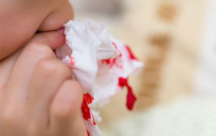 小孩流鼻血怎么办 为什么小孩容易流鼻血
