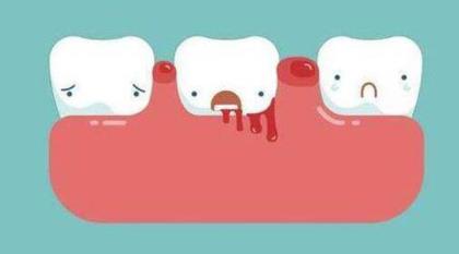 为什么医生不推荐洗牙 哪些人不适合洗牙