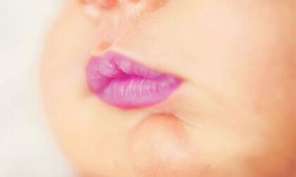 嘴唇发紫是什么原因 嘴唇发紫怎么办