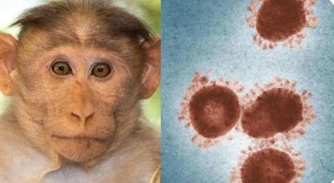 猴痘会变得更危险吗 这种能让人毁容的病毒有多可怕